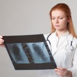 アスベストが原因で生じるアスベスト肺 どんな症状が出る?