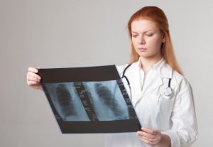 アスベストが原因で生じるアスベスト肺　どんな症状が出る？